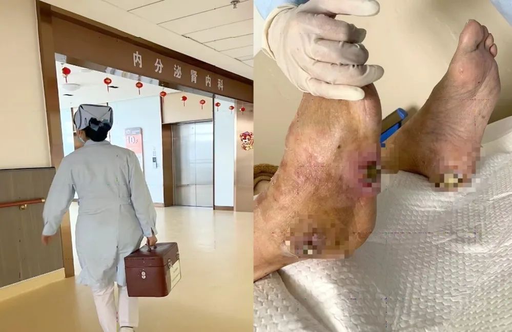 【保山安利醫(yī)院】傷口治療一站式，健康生活零距離！